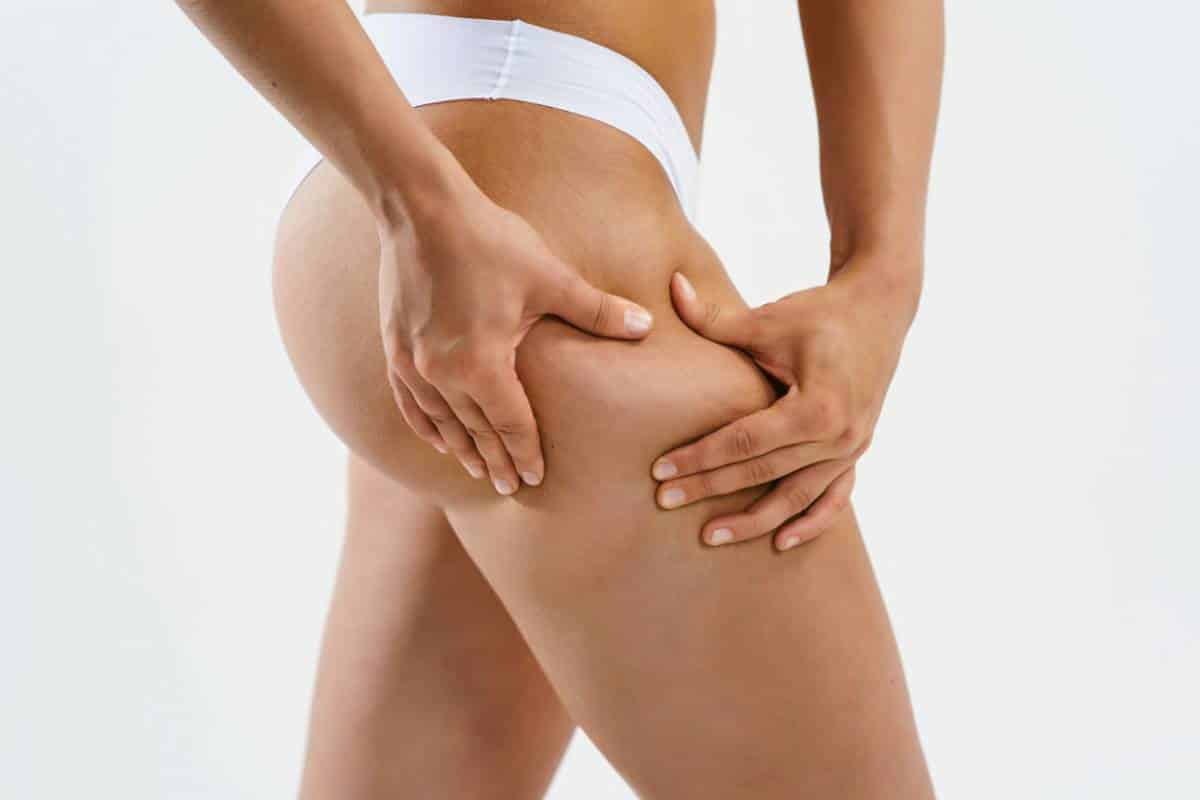 Liposuccion : quels endroits du corps choisir ?